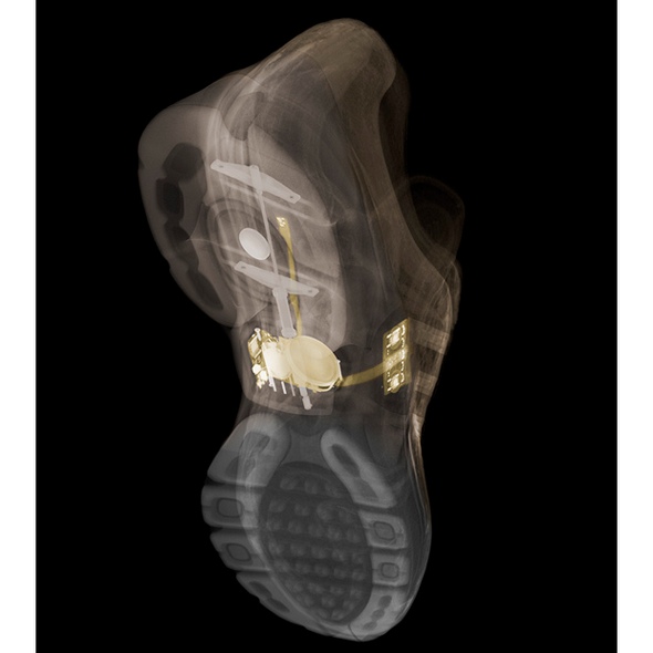 x ray photo nick 26 in Creative X Ray photo artwork by Veasey