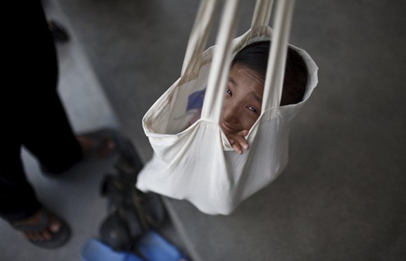 Smallest Man In The World From Nepal