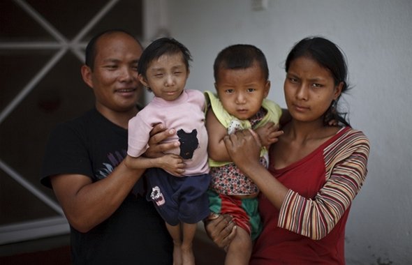 Smallest Man In The World From Nepal