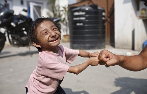 Smallest Man In The World From Nepal