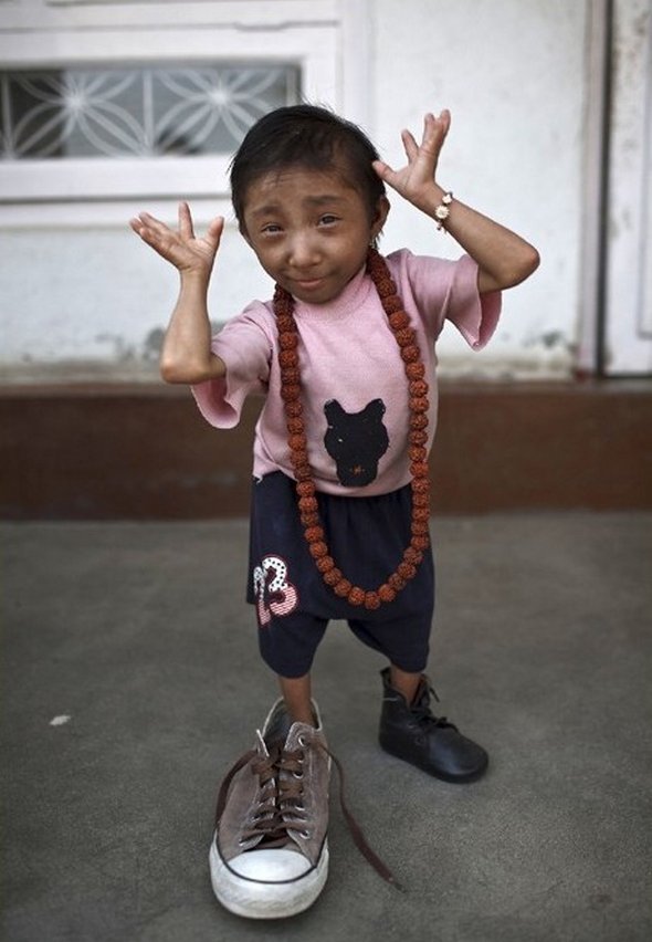 Smallest Man In The World From Nepal