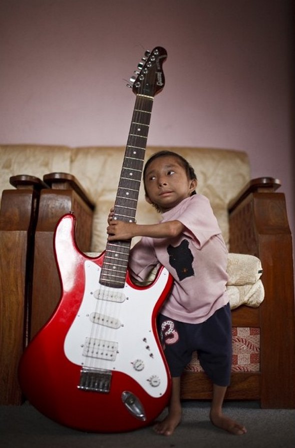 Smallest Man In The World From Nepal