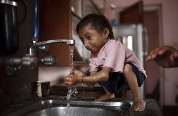 Smallest Man In The World From Nepal