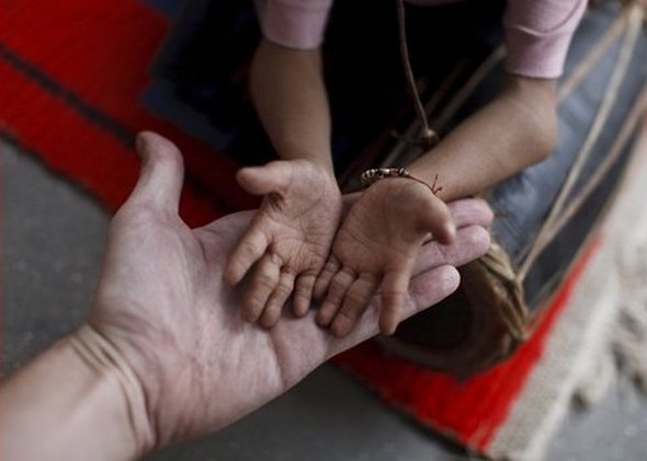 Smallest Man In The World From Nepal