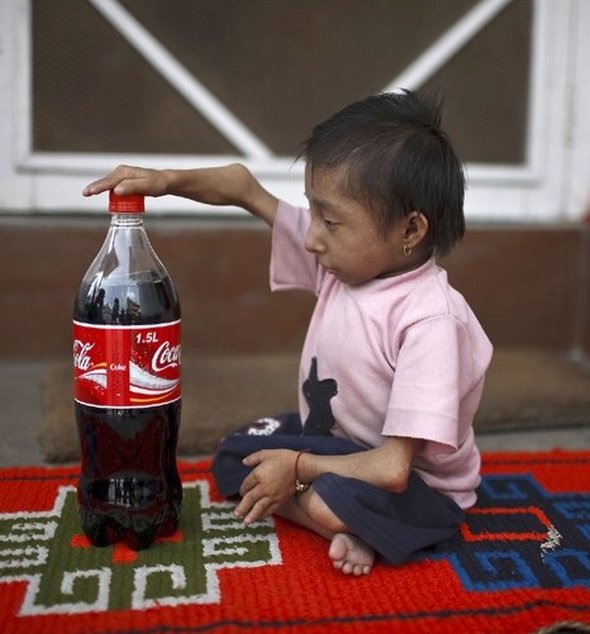 Smallest Man In The World From Nepal