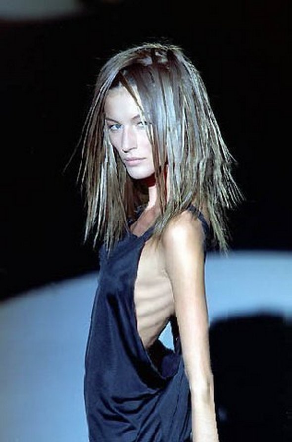 Anorexic Models don’t Always Look Like Models