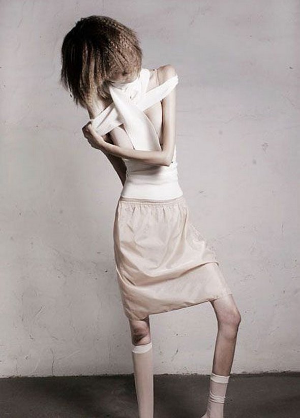 Anorexic Model 86