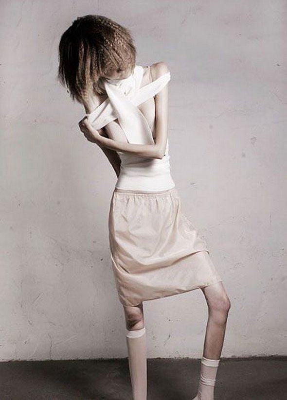 Anorexic Models don’t Always Look Like Models