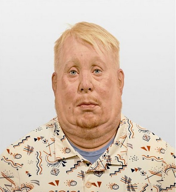 Stooped People in Hyper-real Sculptures of Evan Penny hyper real sculptures of evan penny 21 in Stooped People in Hyper real Sculptures of Evan Penny