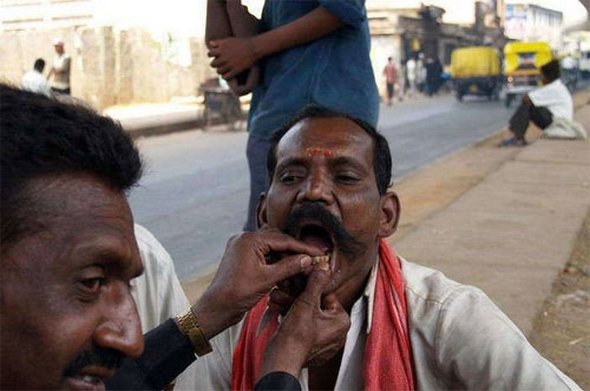 street dentists 03 in Free Street Dentists In India and China