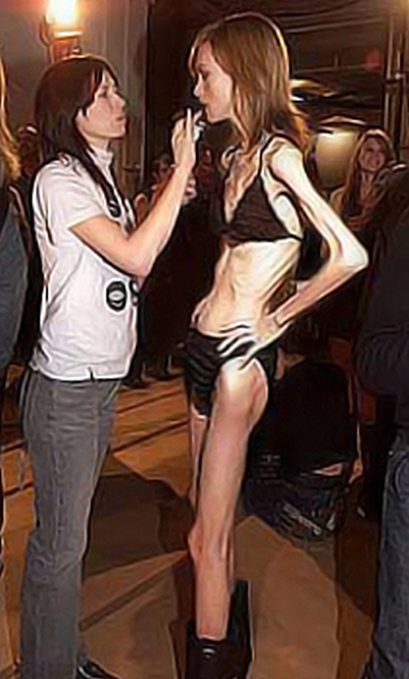anorexic models 14 in Anorexic Models don’t Always Look Like Models