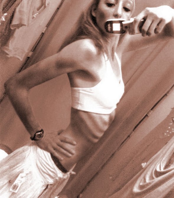 anorexic models 17 in Anorexic Models don’t Always Look Like Models
