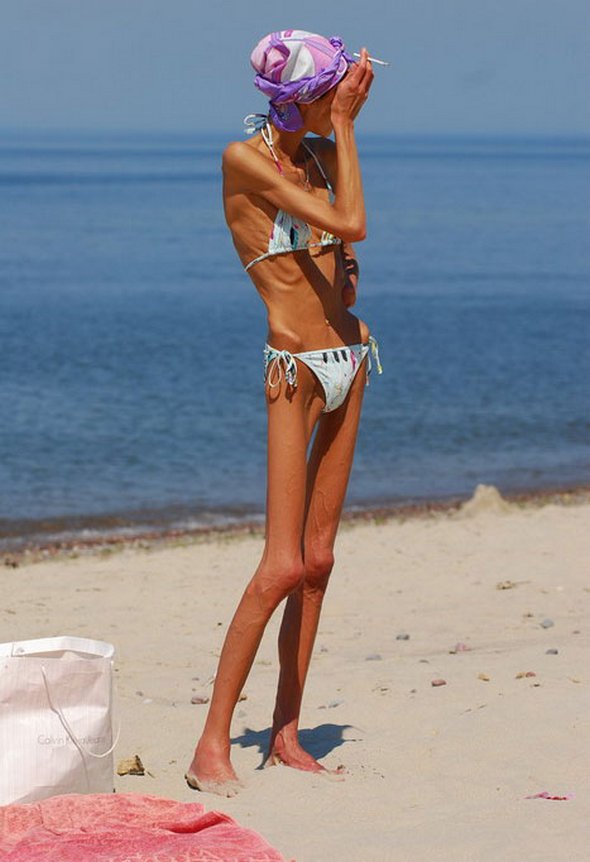 anorexic models 18 in Anorexic Models don’t Always Look Like Models